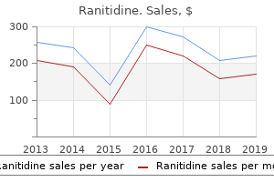 buy 150mg ranitidine with mastercard