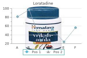 loratadine 10 mg sale