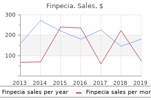 order finpecia 1mg with amex