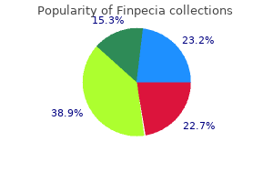 purchase finpecia 1 mg on line
