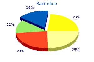 buy generic ranitidine 300mg line