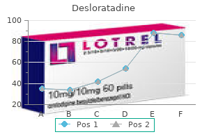 purchase desloratadine with paypal