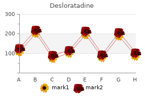 generic 5mg desloratadine mastercard